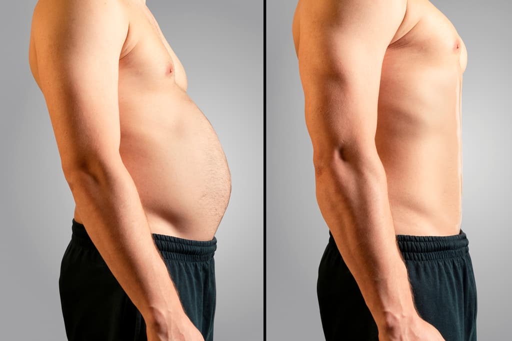 elite body sculpture, weight loss