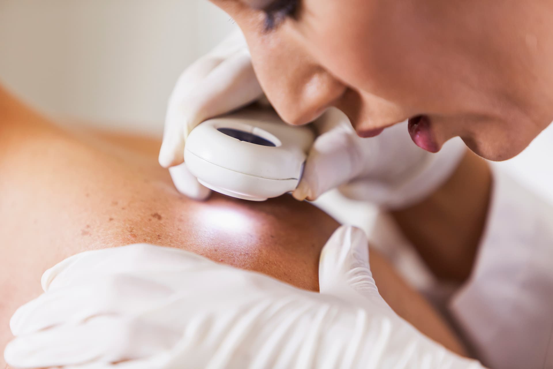 Dermatologist examining for signs of cancer