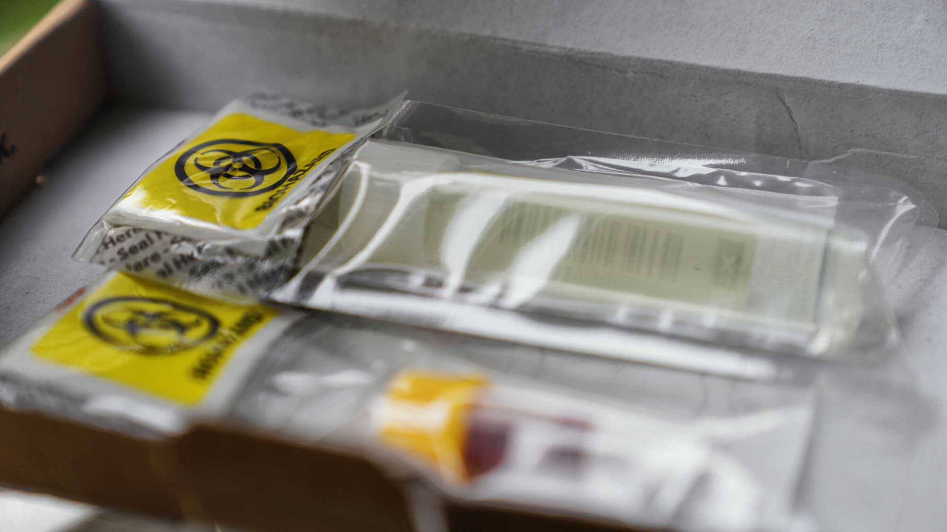 Urine Container: plastic tube in a Biohazard Bag inside a Box. Healthcare concept: blood test. Urine Sample Test Kit.