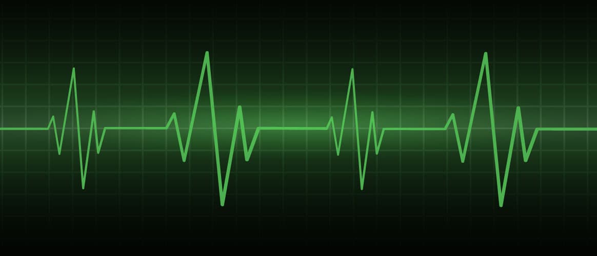 Hospital heart monitor showing a patient's heart rate